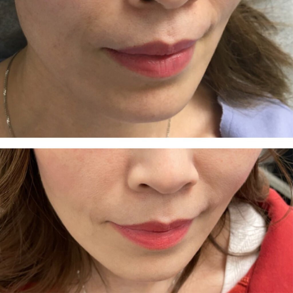 Facial dermall photos2