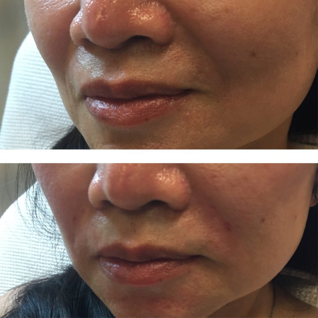 Facial dermall photos5